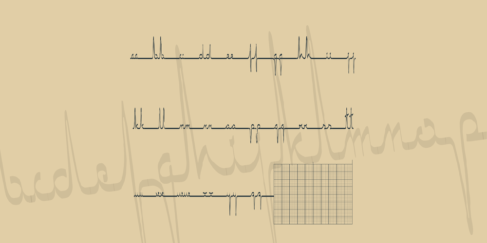 ECG saji